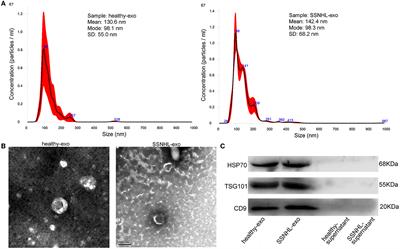 Differentially expressed miRNA profiles of serum-derived exosomes in patients with sudden sensorineural hearing loss